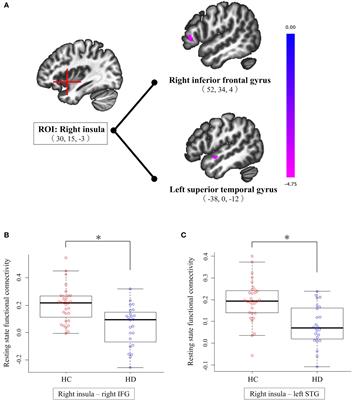 Reduced resting-state functional connectivity between insula and inferior frontal gyrus and superior temporal gyrus in hoarding disorder